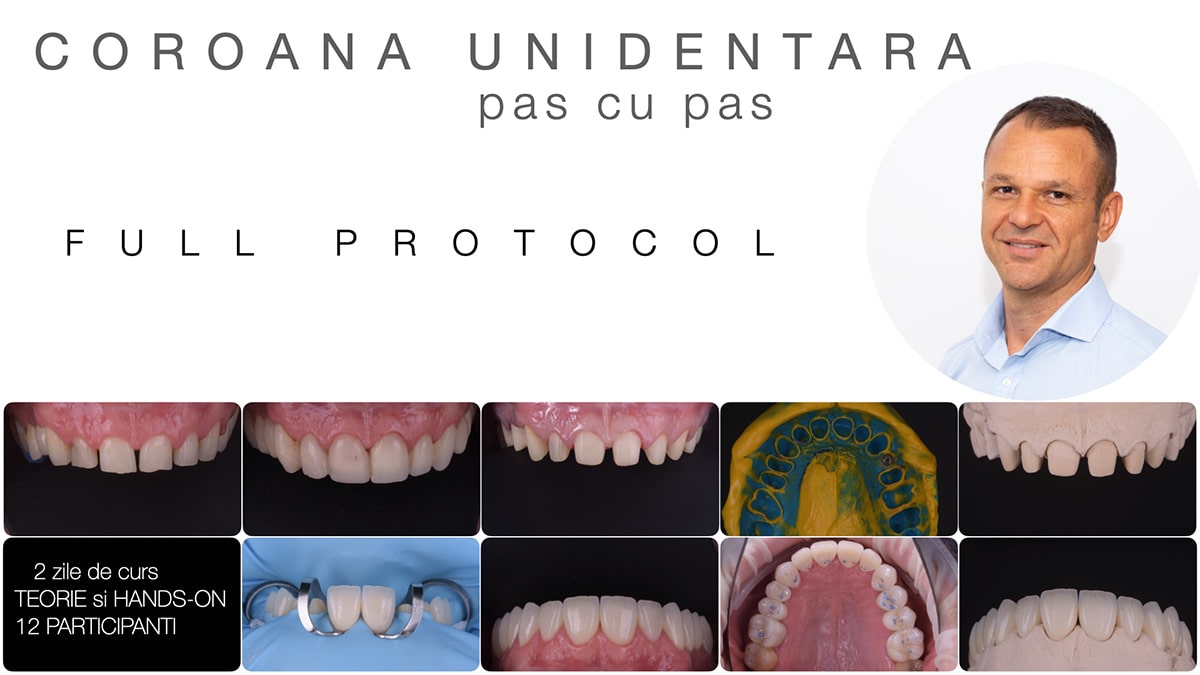 Coroana unidentara Pas cu pas​ dr robert ciocirlan rc learning cursuri protetica dentara